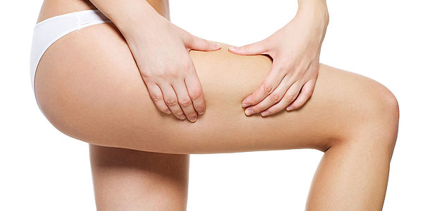 Common Causes of Cellulite